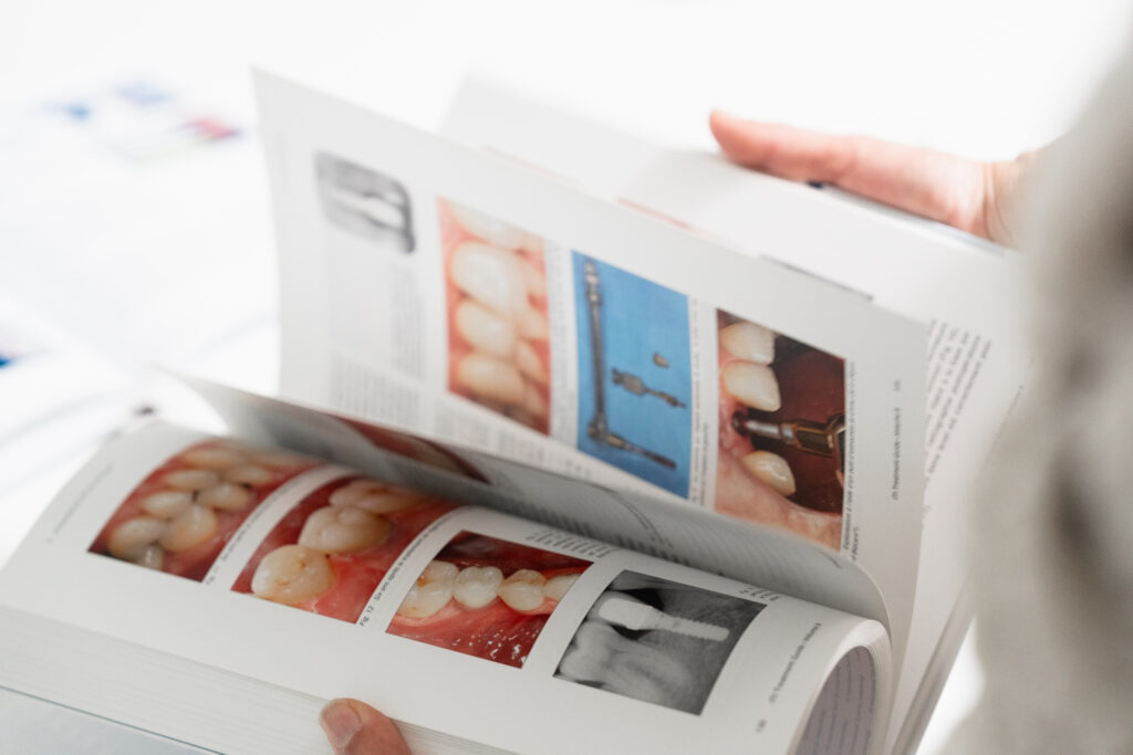 Publication scientifique en implantologie dentaire évaluation clinique et suivi des implants
